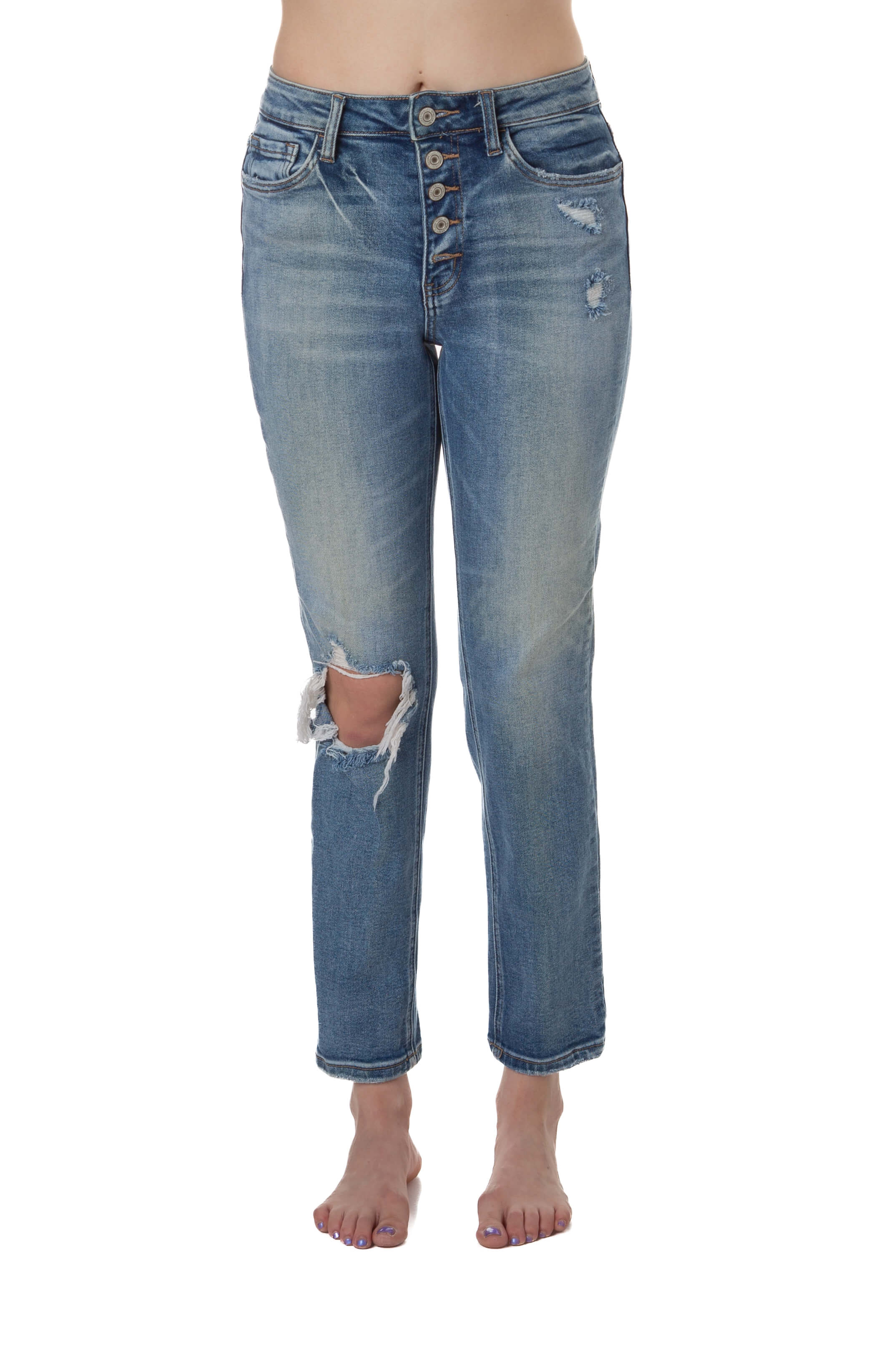Vervet, Talla 25